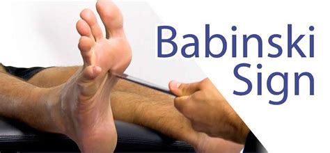 Babinski reflex test & causes of positive Babinski reflex in adults