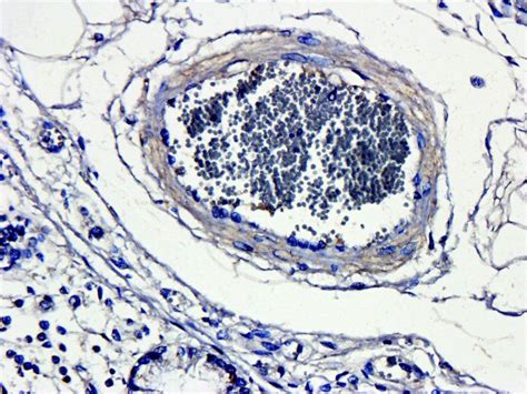 CD4 antibody | Biorbyt