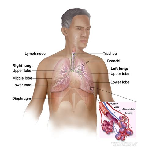 Small Cell Lung Cancer Treatment - NCI