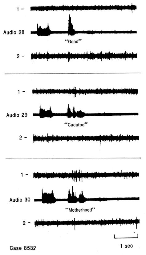 Single neuron activity related to second and subsequent syllables ...