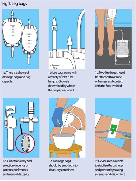 Maintaining A Foley Catheter Drainage Bag In The Dependent Position ...