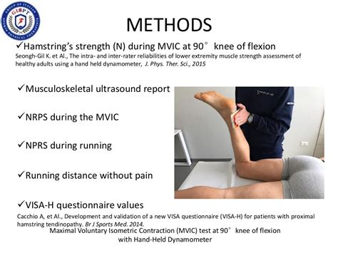 BILATERAL PROXIMAL HAMSTRING TENDINOPATHY IN ULTRAMARATHON RUNNER