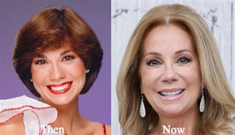 Kathie Lee Gifford Plastic Surgery Before and After Photos - Latest Plastic Surgery Gossip And ...