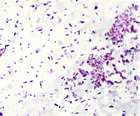 Fix An Acid-Fast Organism That’s Not Retaining Dye • Ethos Biosciences