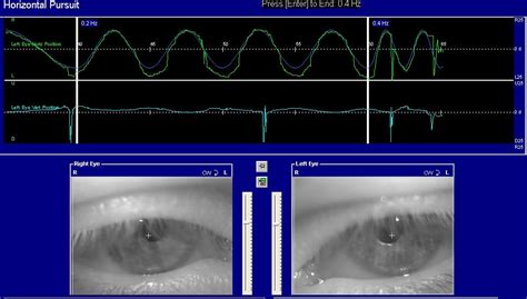 Tracking Test