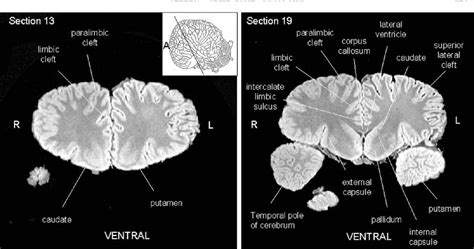 Figure 1 from Neuroanatomy of the killer whale (Orcinus orca) from magnetic resonance images ...