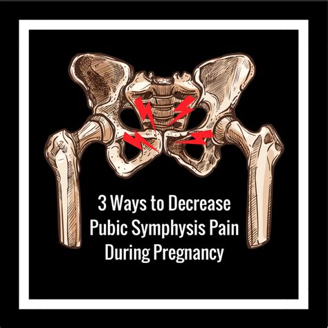 3 Ways to Decrease Pubic Symphysis Pain During Pregnancy — Heppe Chiropractic