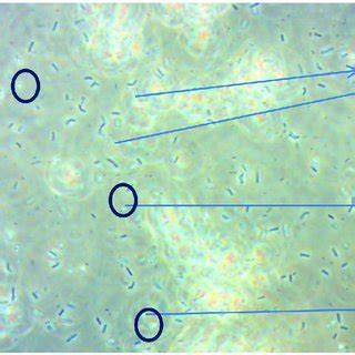 Survivals of Bacillus amyloliquefaciens spores after high pressure... | Download Scientific Diagram