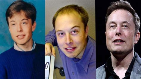 Real Truth About Elon Musk’s Plastic Surgery – Facelift & Hair Transplant? | Plastic surgery ...