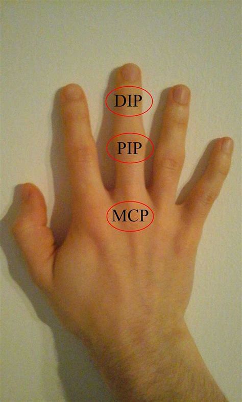 Interphalangeal Joints of the Hand - Physiopedia