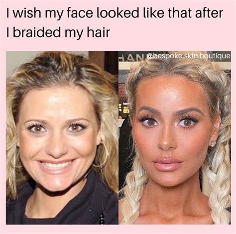 Same😂 . . Her Botox & filler look good here 💉🤣 | Botox fillers, Botox ...