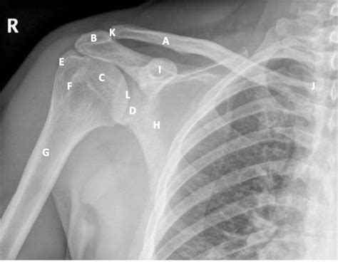 shoulder anatomy Diagram | Quizlet
