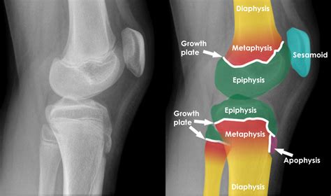 子供の骨の部位における成長割合について - Daily Orthopedics ~整形外科チャンネル~