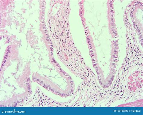 Histology of Human Gallbladder Tissue Stock Image - Image of columnar, human: 153109329