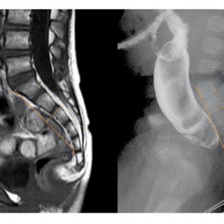 | SC measurement in MRI and x-ray. | Download Scientific Diagram