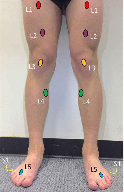 Dermatomes Lower Limb