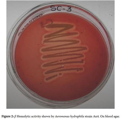 Aeromonas Bacteria | Medical Laboratories