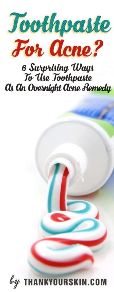 Toothpaste For Acne? 6 Surprising Ways To Use Toothpaste As An ...