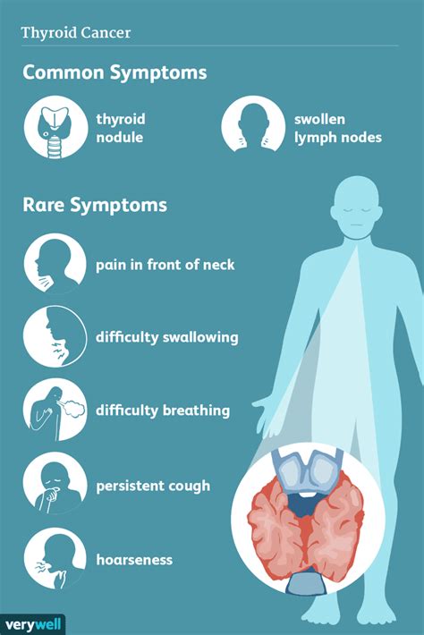 Thyroid Cancer: Signs, Symptoms, and Complications