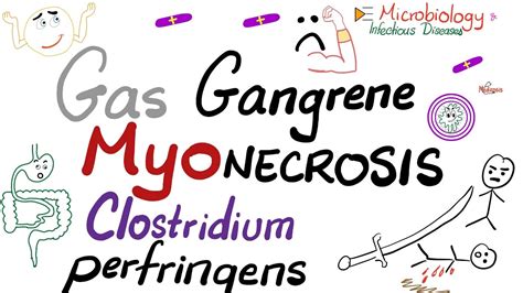 Gas gangrene & Myonecrosis | Clostridium perfringens - YouTube