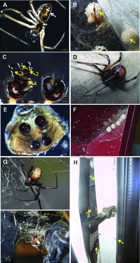 Common morphological characteristics of Latrodectus geometricus... | Download Scientific Diagram