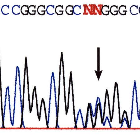 Somatic mutation of the VHL gene in MEN2-associated MTC. Portion of the... | Download Scientific ...