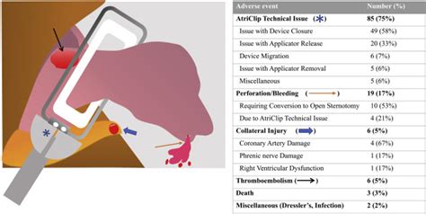 Adverse events associated with the AtriClip device for left atrial ...