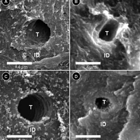 Density and diameter of the dentin tubules by SEM. A. Dentin tubules of... | Download Scientific ...