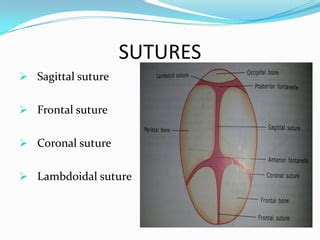 Sutures Of The Fetal Skull