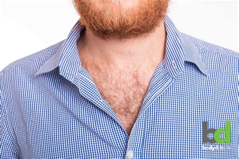 Laser Chest Hair Removal - 10 Things Men Need to Know