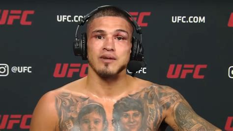 PFL Signs Former Champion Anthony "Showtime" Pettis