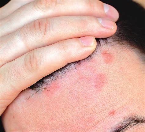 Red spots on scalp: Pictures, causes, and treatments