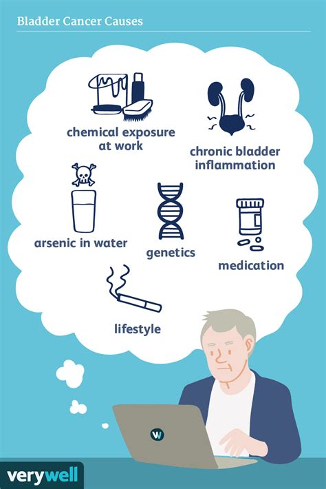 Causes and Risk Factors of Bladder Cancer