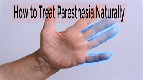 Paresthesia Treatment : how to treat paresthesia naturally || get rid of Paresthesia permanently ...