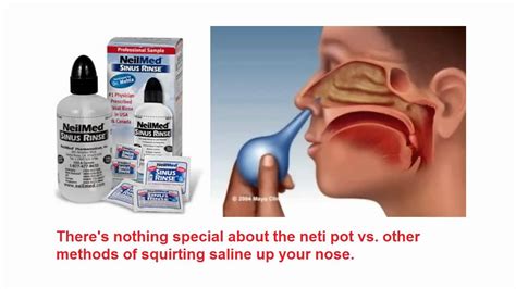 24+ Neti Pot Squeeze, Inspirasi Terbaru!