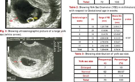 yolk sac size chart