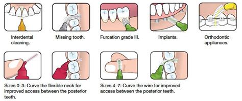 Interdental Brushes For Braces