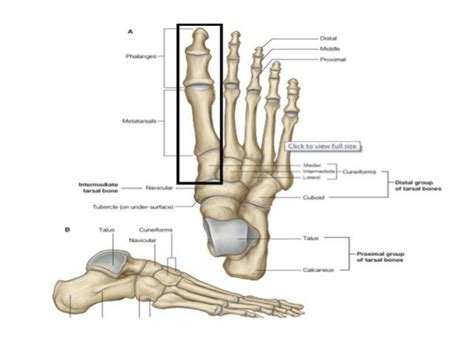 Hallux Valgus - A Detailed Outline