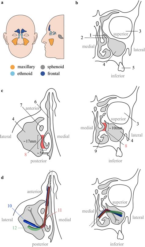 Maxillary sinus anatomy. (a),Location of the paranasal sinuses (Adapted... | Download Scientific ...