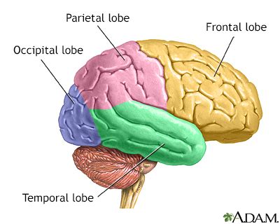 Head MRI Information | Mount Sinai - New York