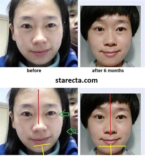 How to develop, widen and make your face more symmetrical