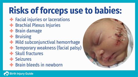 Why Are Forceps Linked to Birth Injuries? - Birth Injury Guide