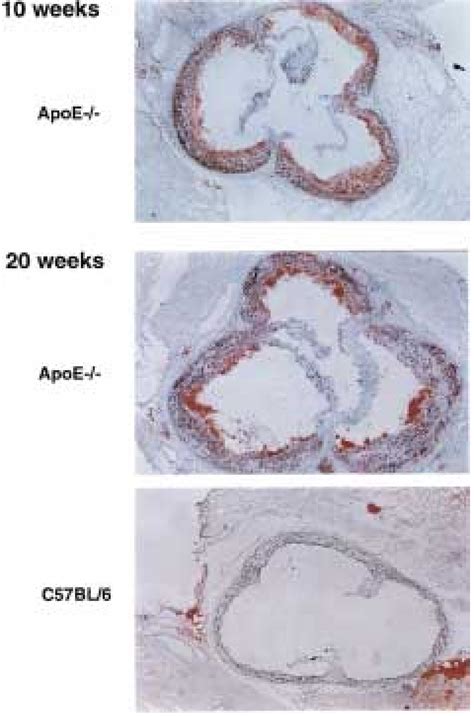 The histology of the extent of atherosclerosis lesions is shown. The... | Download Scientific ...