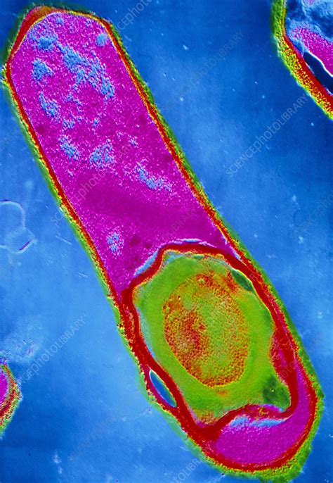 Clostridium perfringens bacterium with spore - Stock Image - B220/0531 - Science Photo Library