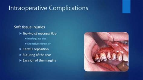 Complications of oral surgery