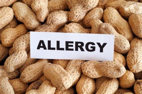 New Peanut Allergy Drug Shows ‘Lifesaving’ Potential | Caduceus Medical ...