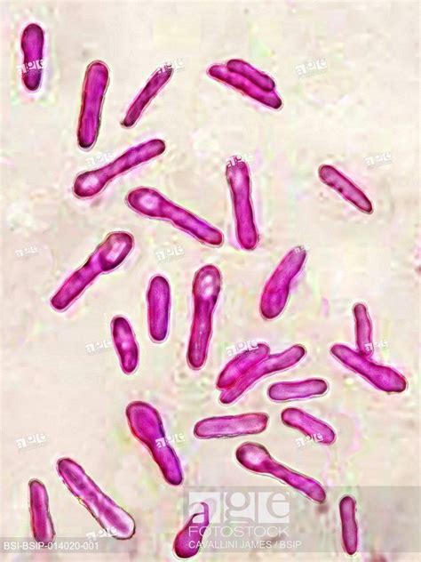 botulinum bacteria spores - Google Search | Spore, Clostridium ...