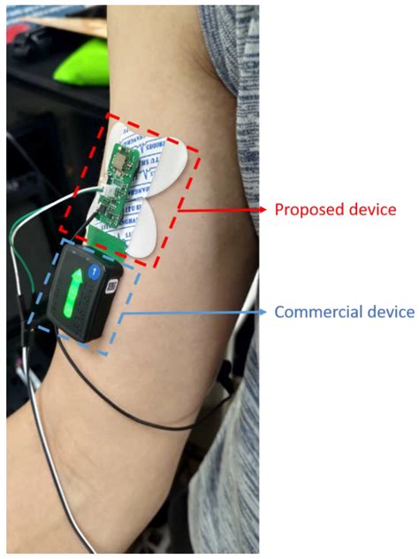 Biosensors | Free Full-Text | An Ultra-Low Power Surface EMG Sensor for ...