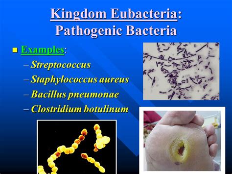 Examples Of Eubacteria