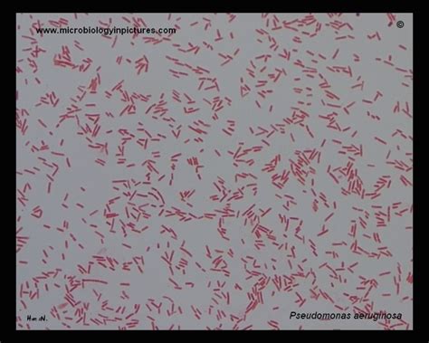 Pseudomonas aeruginosa Gram stain. Gram-stained cells of Pseudomonas aeruginosa. Pseudomonas ...
